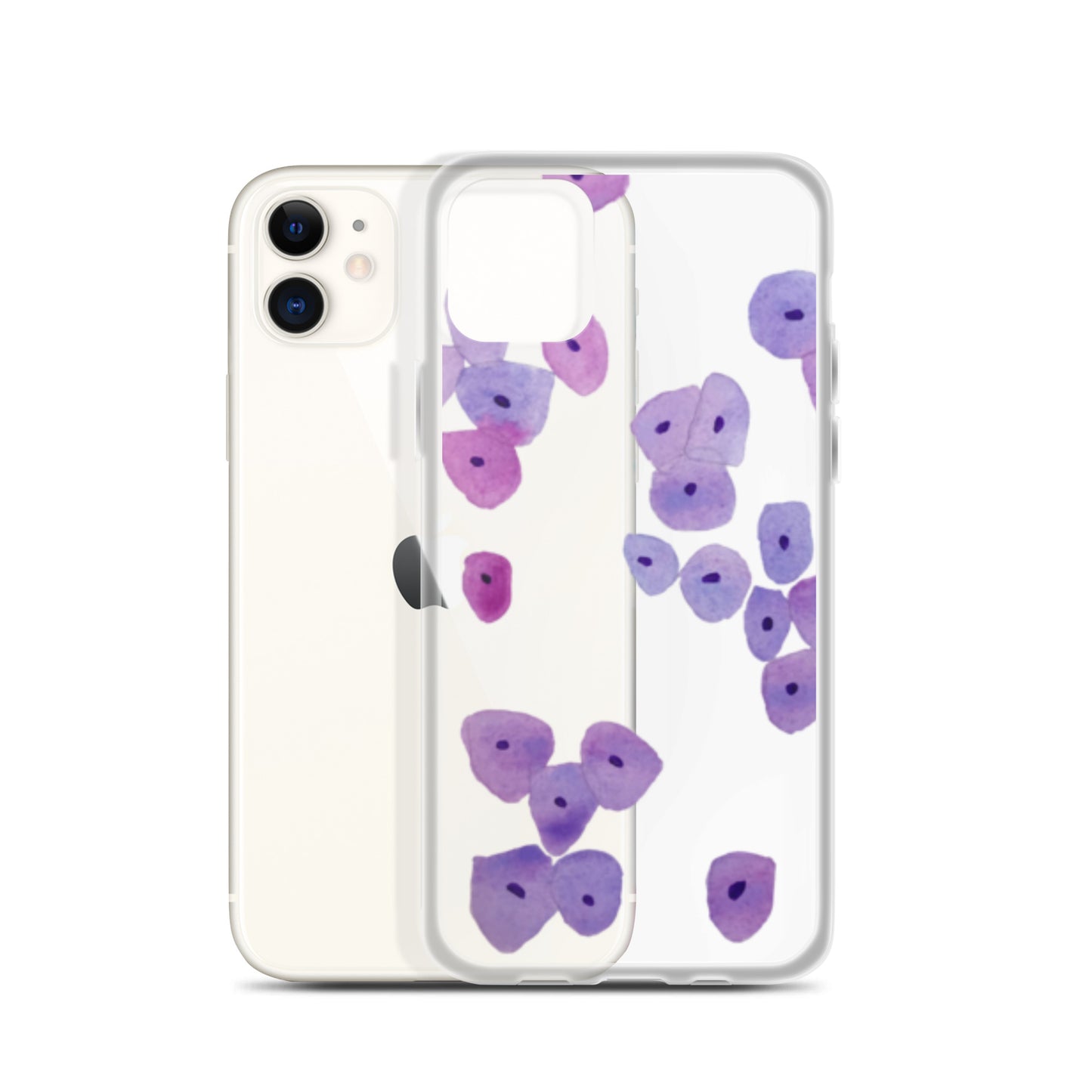 Epithelium Clear Case for iPhone®