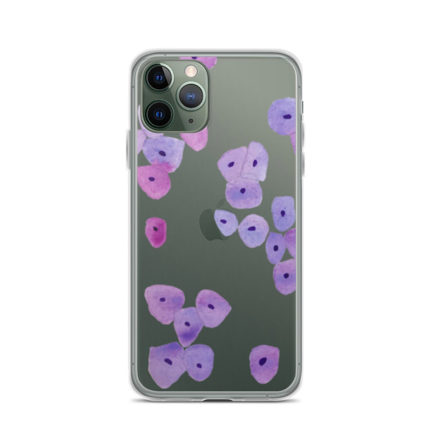 Epithelium Clear Case for iPhone®