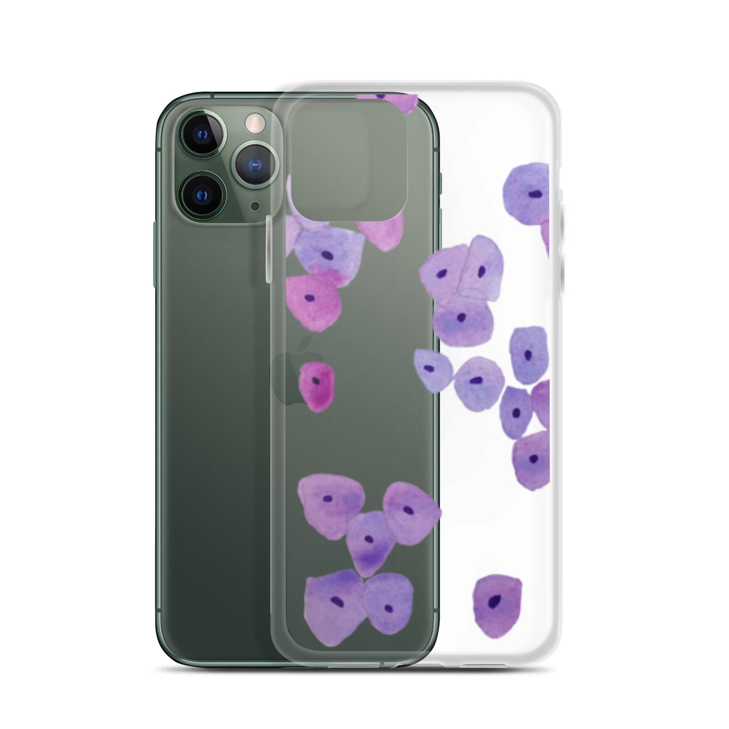 Epithelium Clear Case for iPhone®