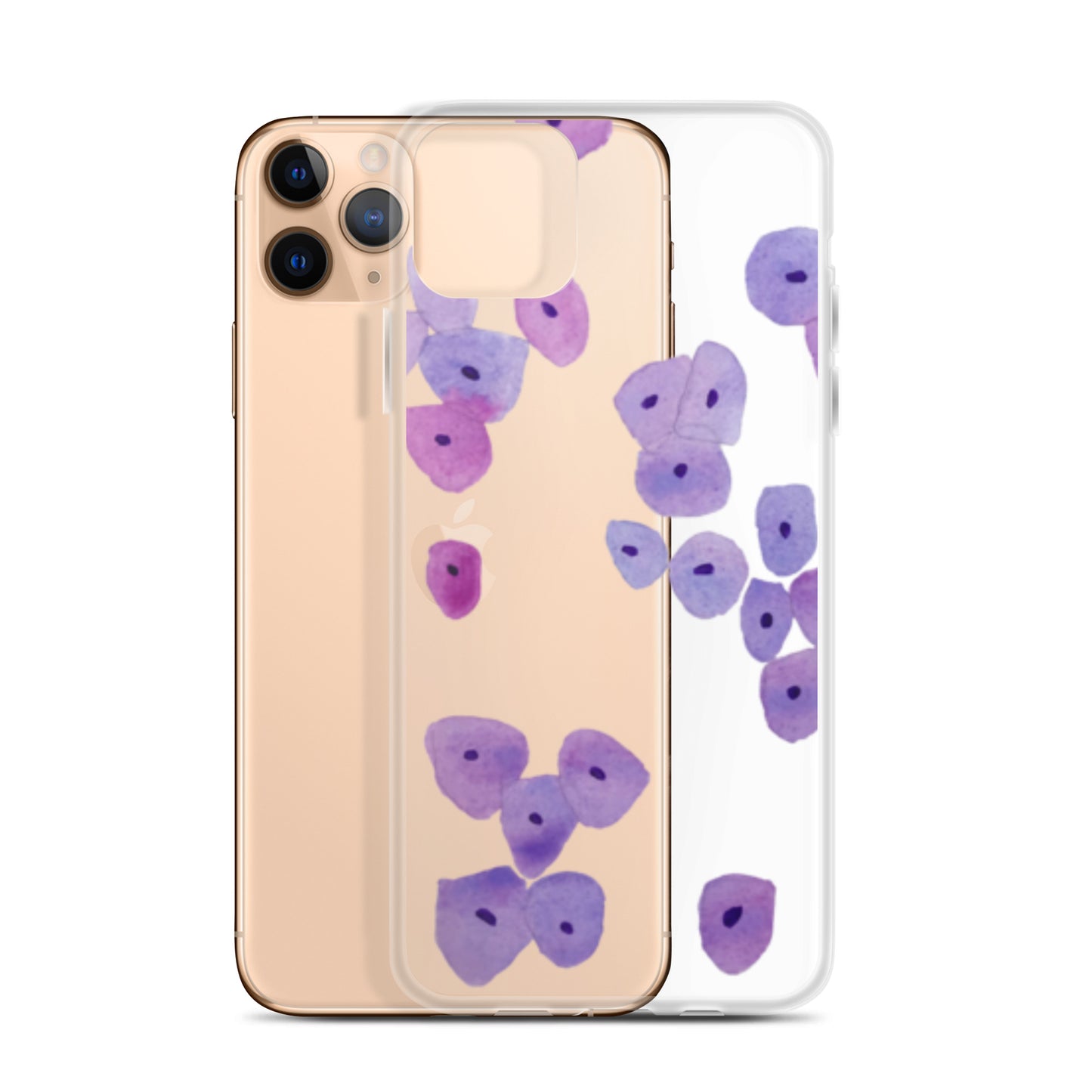Epithelium Clear Case for iPhone®