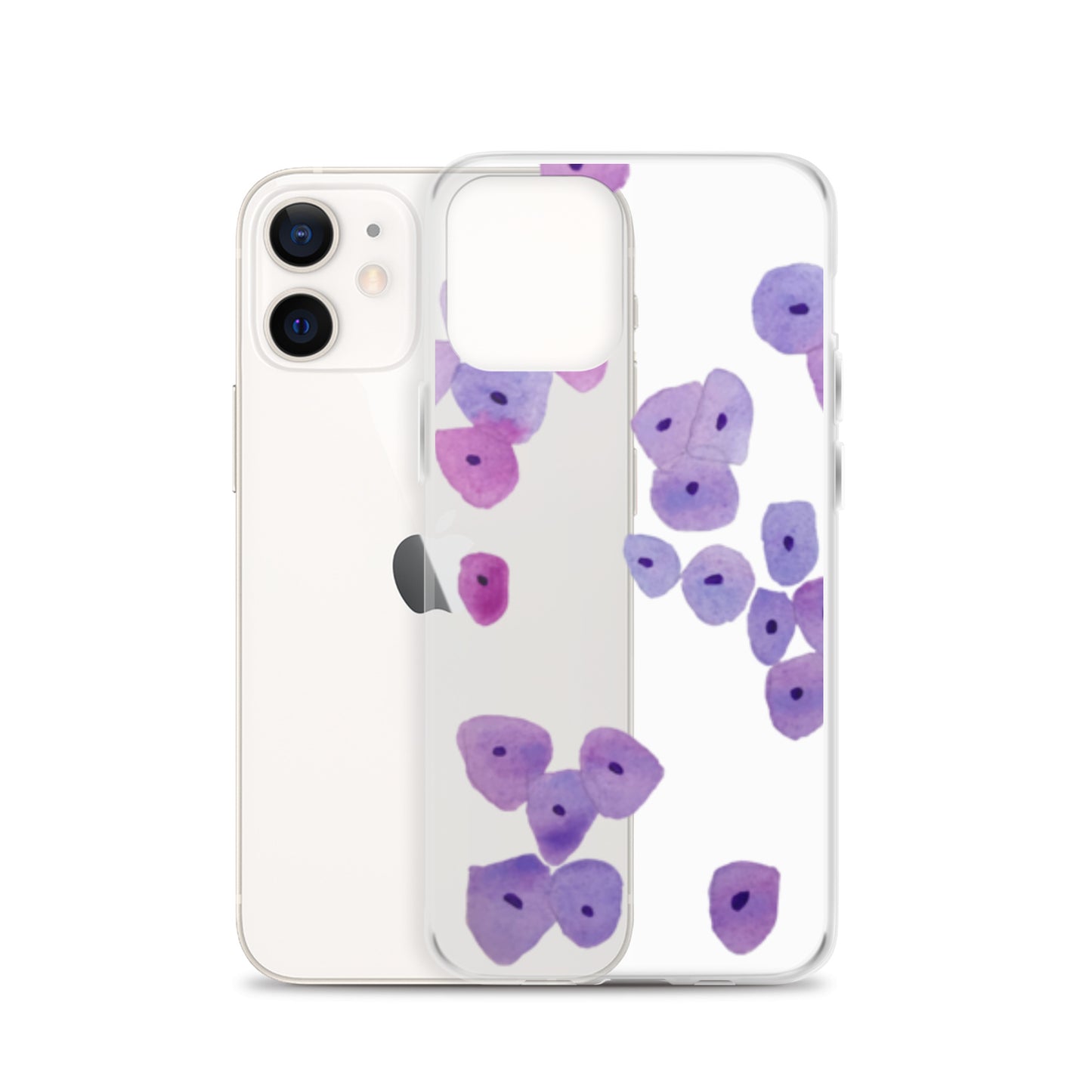 Epithelium Clear Case for iPhone®