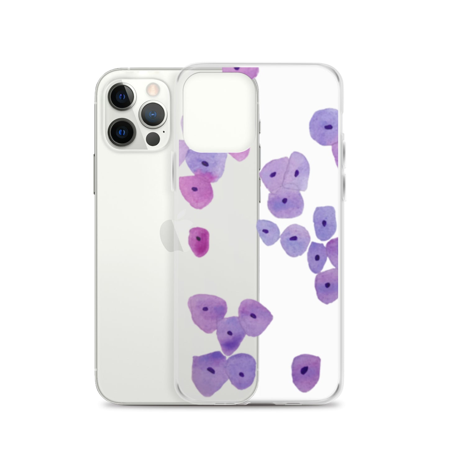 Epithelium Clear Case for iPhone®