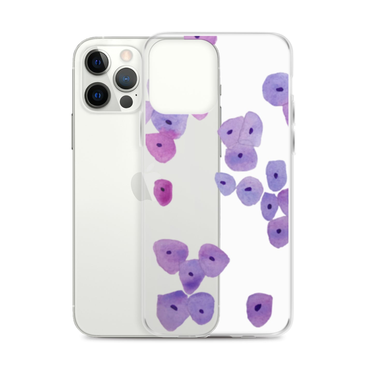 Epithelium Clear Case for iPhone®