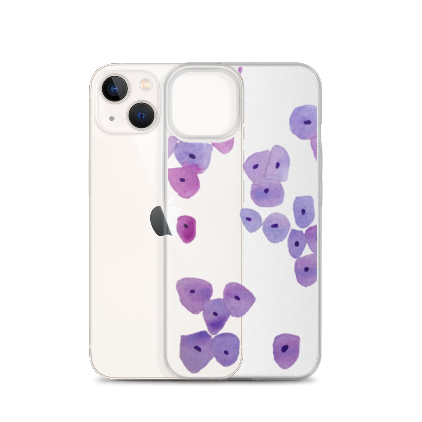 Epithelium Clear Case for iPhone®