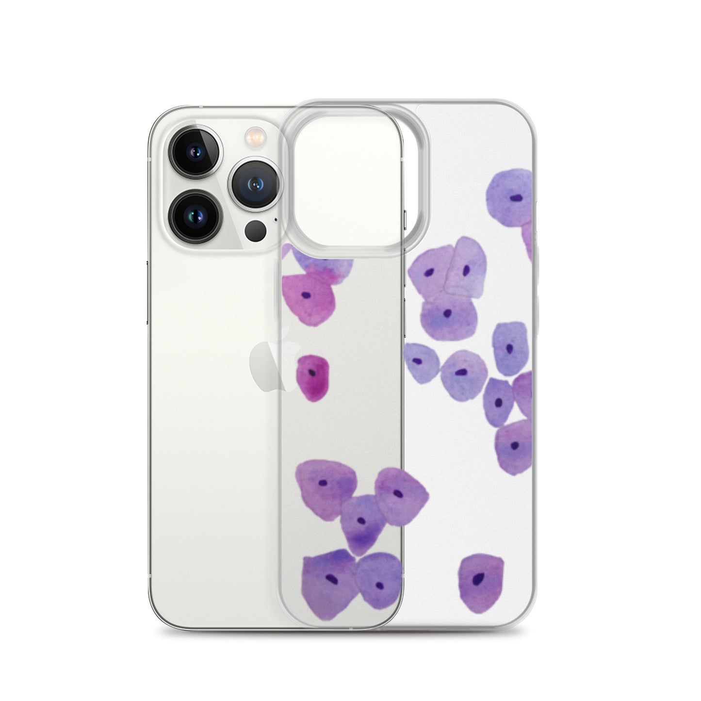 Epithelium Clear Case for iPhone®