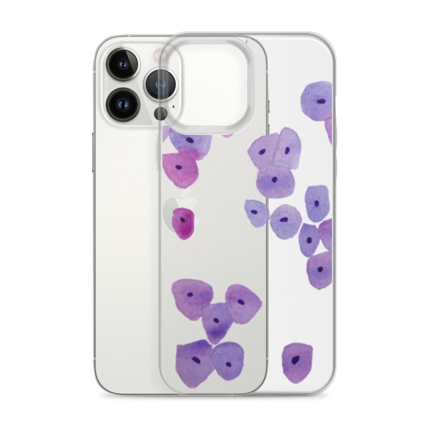 Epithelium Clear Case for iPhone®
