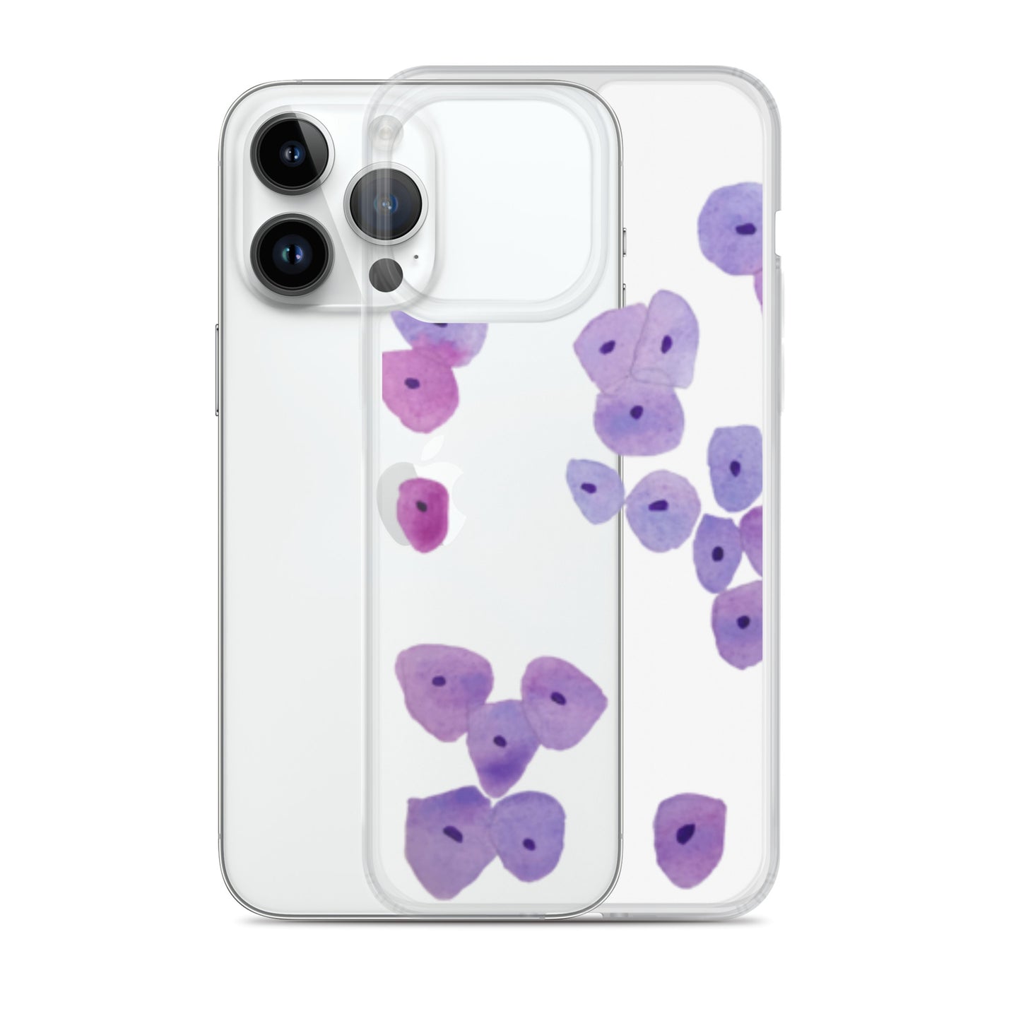 Epithelium Clear Case for iPhone®